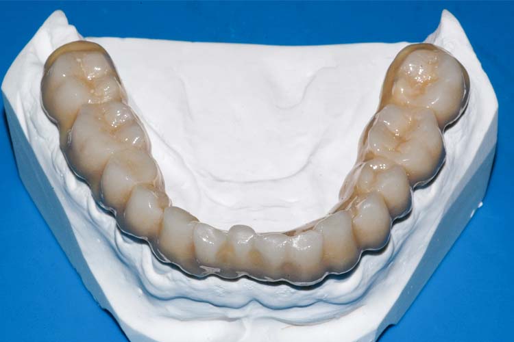 Ortodonzia 2